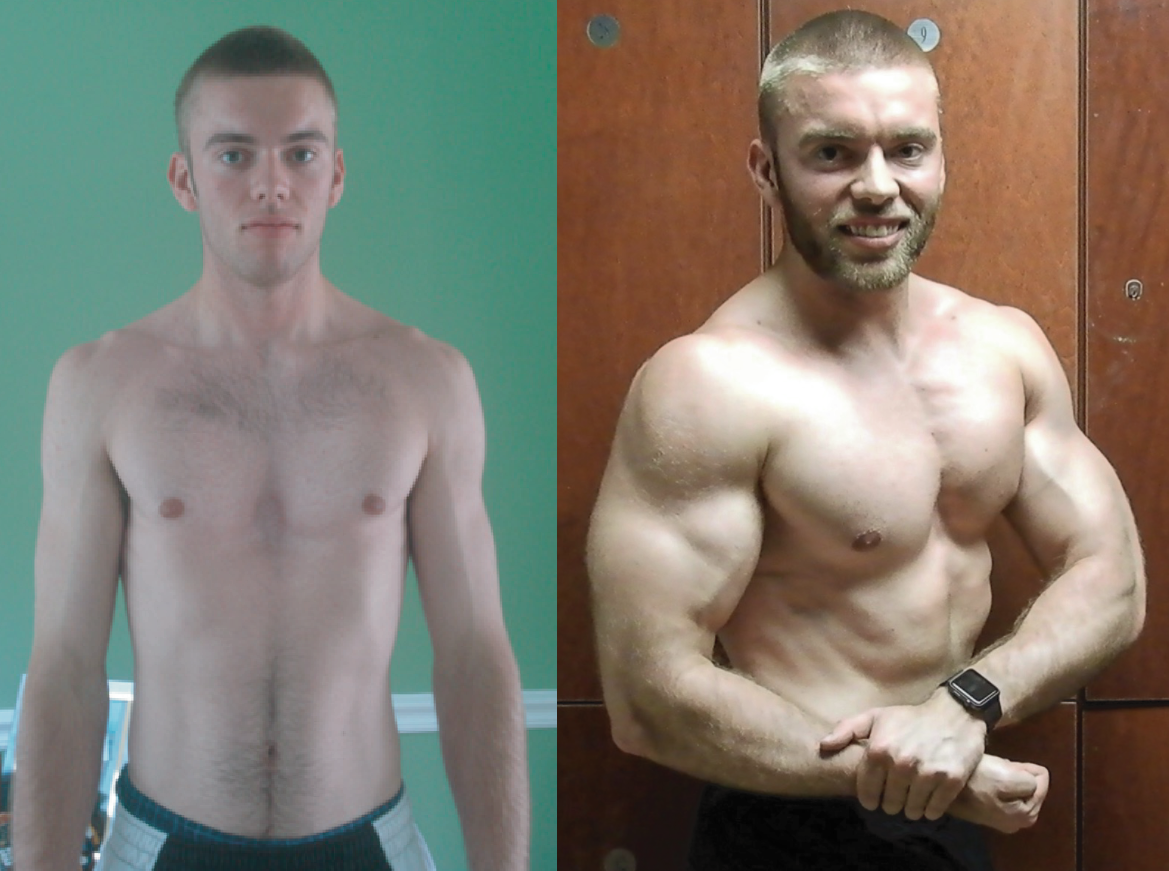 pectus-warriors-program-online-training-program-for-pectus-excavatum